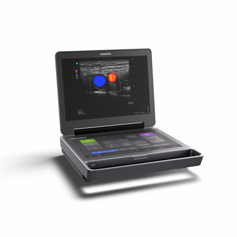 Sonosite MT | Ultrasound Scanner